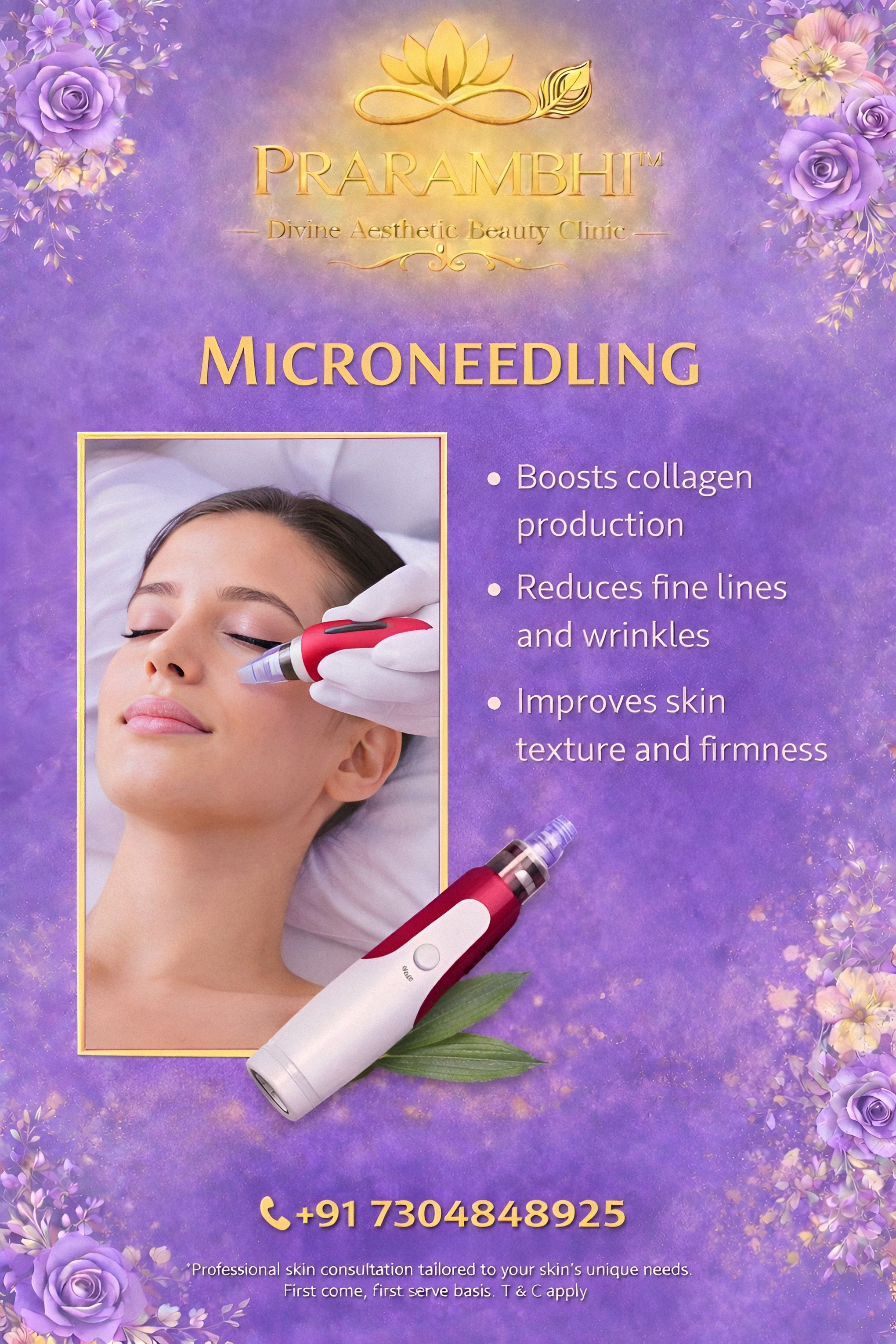 Microneedling treatment